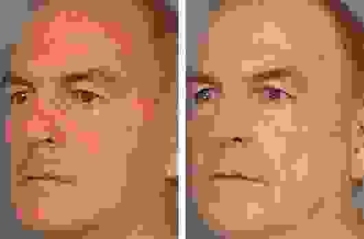 broken image