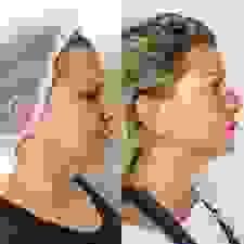 broken image