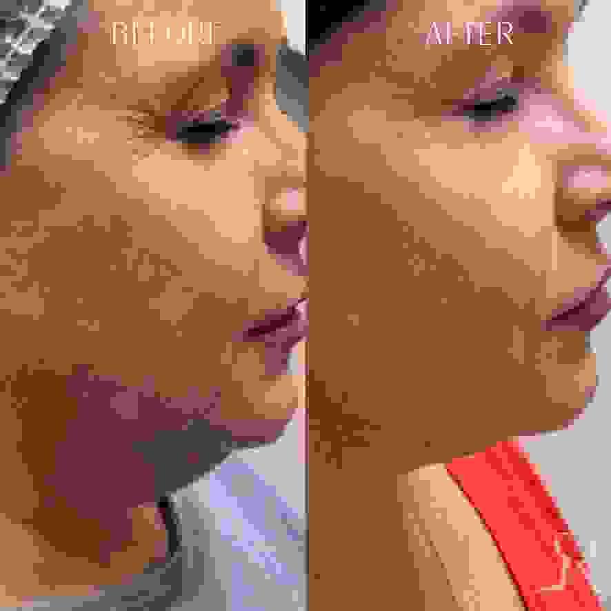 broken image