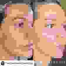 broken image