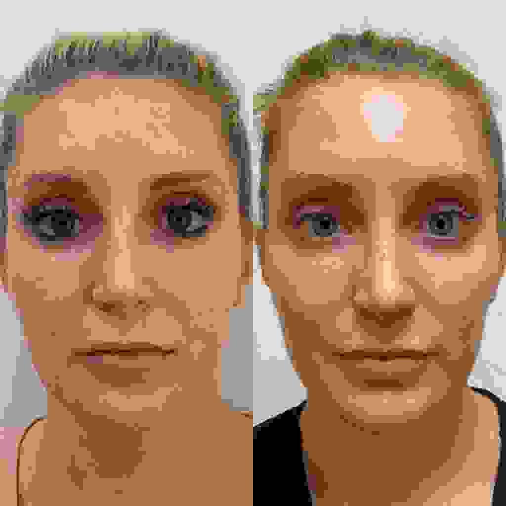 broken image