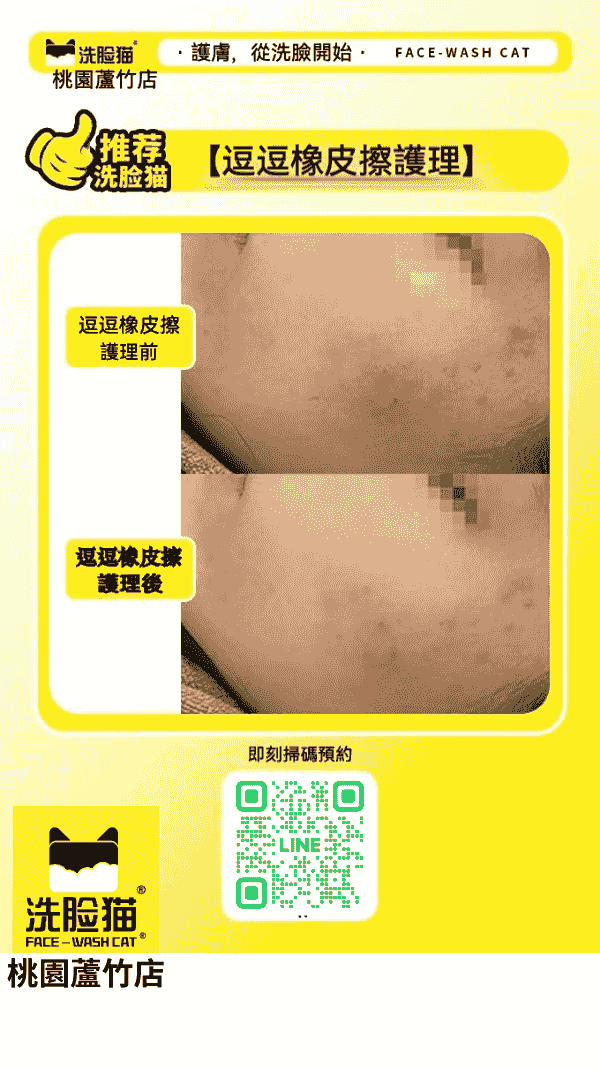 broken image