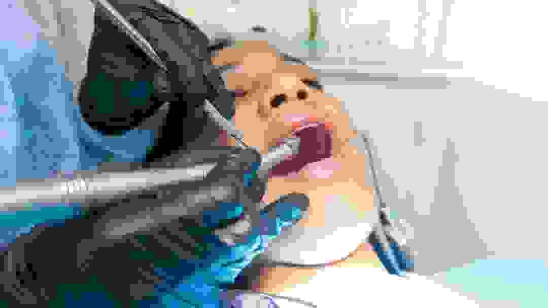 broken image
