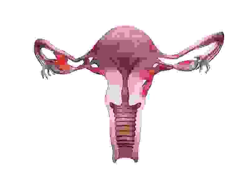 Section image