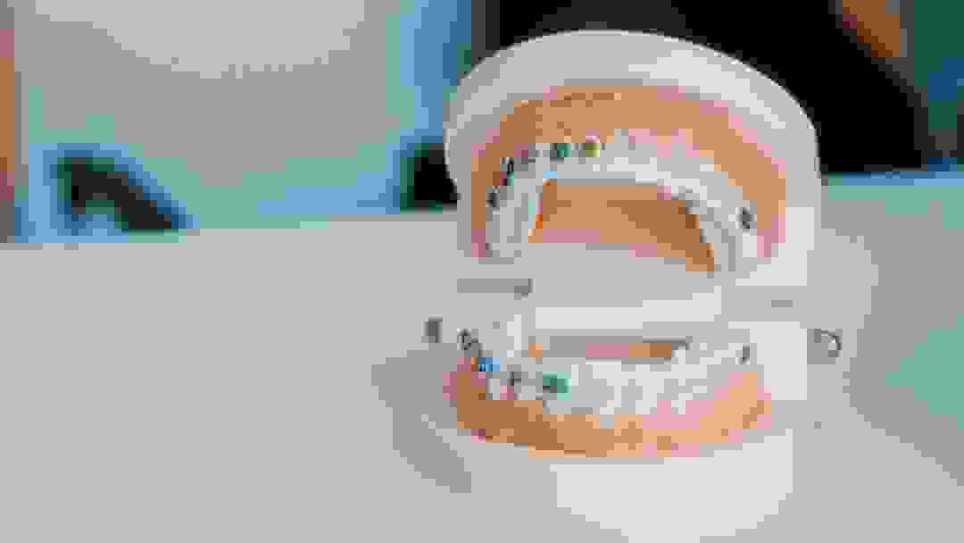broken image