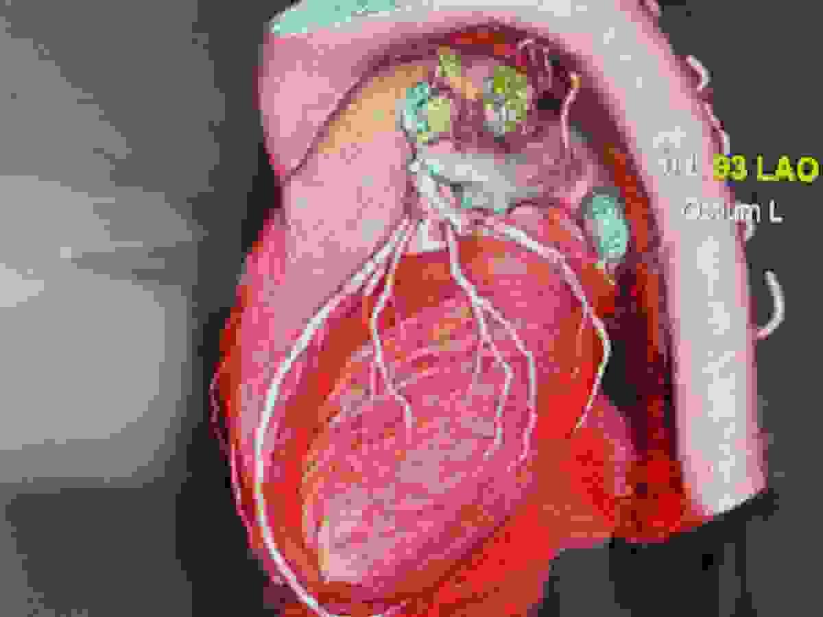 Section image