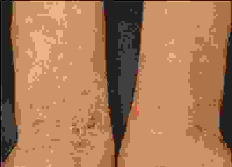 The Tuina massage is an effective form of manual therapy that relieves tension, promotes circulation, and harmonizes the energy flows in the body. Ideal for supporting recovery and for stress reduction. Tuina Massage Our services Traditional Chinese Medicine, acupuncture, moxibustion, tui na, cupping, Chinese herbal medicine The Tuina massage is an effective form of manual therapy that relieves tension, promotes circulation, and harmonizes the energy flows in the body. Ideal for supporting recovery and for stress reduction. Tuina Massage Our services Traditional Chinese Medicine, acupuncture, moxibustion, tui na, cupping, Chinese herbal medicine