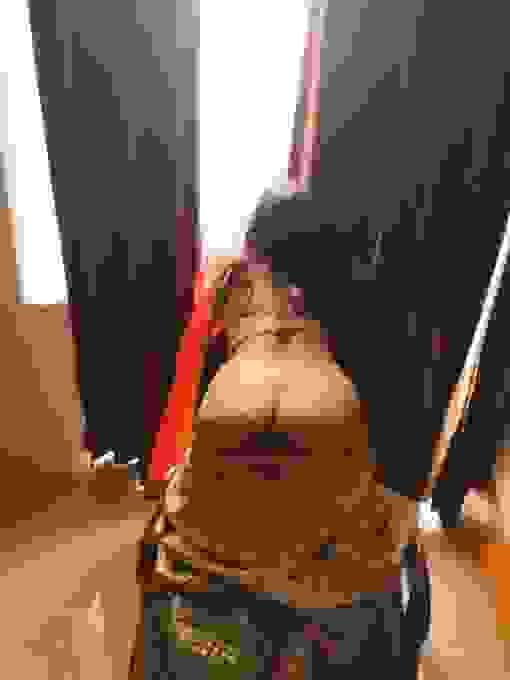 broken image