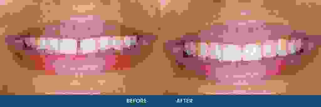 broken image