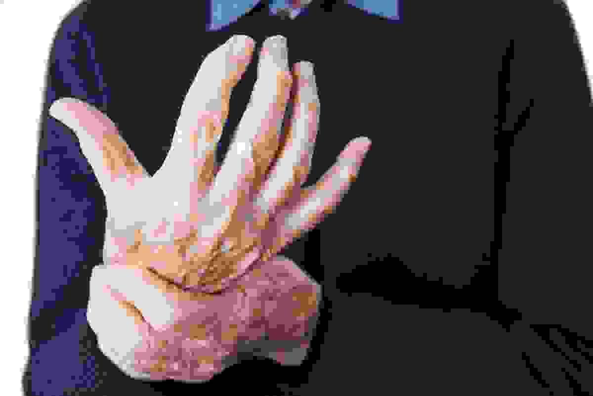 broken image
