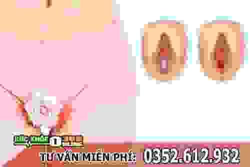 broken image