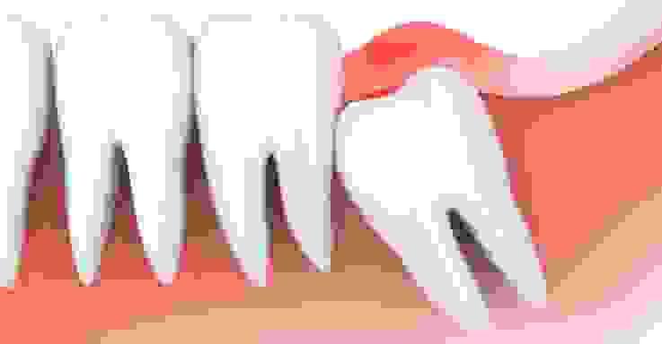 Section image