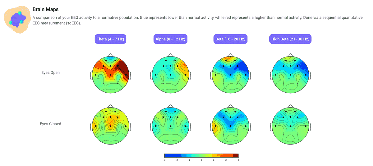 Our easy-to-use at-home scanning system makes brain health monitoring accessible to everyone. No need for complicated procedures; simply follow our straightforward instructions and get immediate results from the comfort of your home. User-Friendly Experience What We Offer A simple, at-home brain scan system that shows how your brain is functioning — and what to do next.
Designed for people dealing with concussion symptoms, brain fog, focus issues, anxiety, or anyone who wants objective insight into their brain health. Our easy-to-use at-home scanning system makes brain health monitoring accessible to everyone. No need for complicated procedures; simply follow our straightforward instructions and get immediate results from the comfort of your home. User-Friendly Experience What We Offer A simple, at-home brain scan system that shows how your brain is functioning — and what to do next.
Designed for people dealing with concussion symptoms, brain fog, focus issues, anxiety, or anyone who wants objective insight into their brain health.
