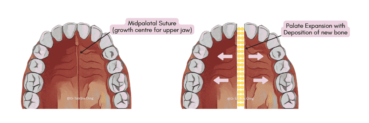 Section image
