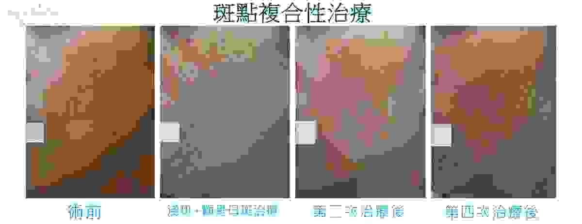 broken image
