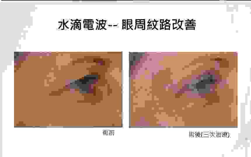 broken image