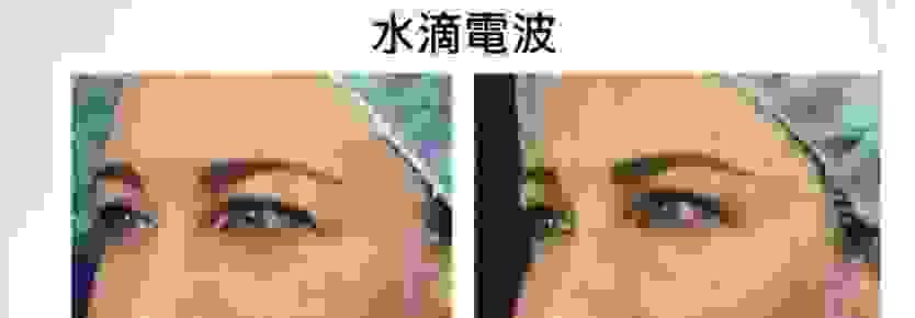 broken image