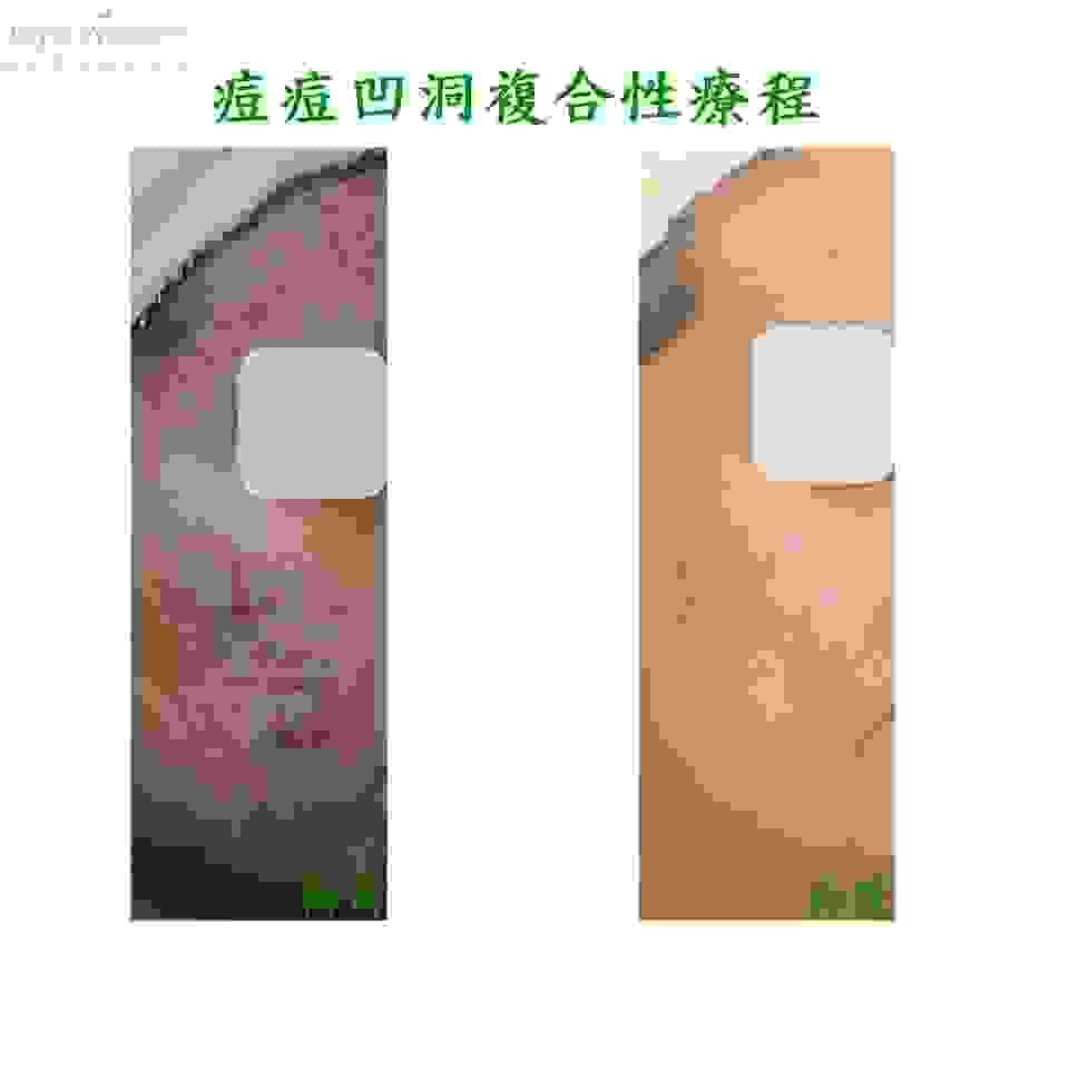 broken image
