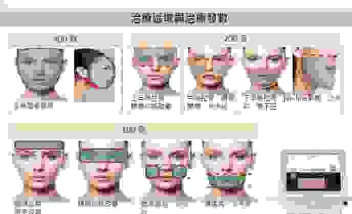 broken image