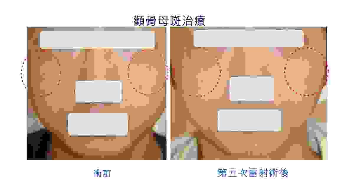 broken image