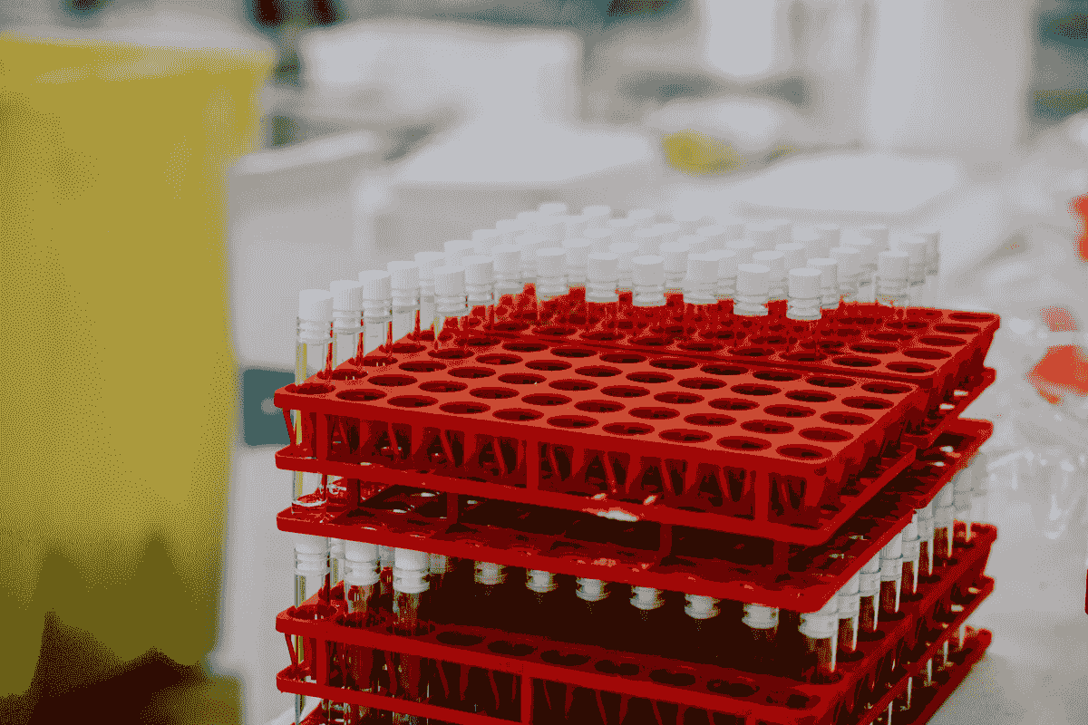 LFGB Test conducted by professionals analyzing general plastic products