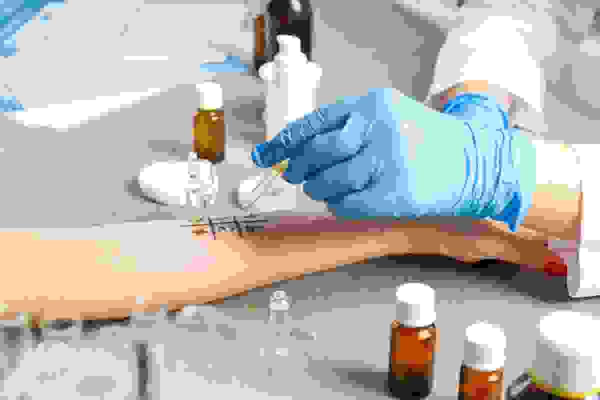 Allergic reaction Testing