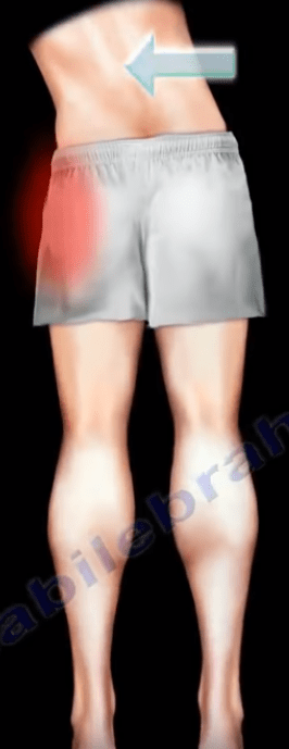Antalgic Antalgic Gait - Gait Nabil Ebraheim Healthcare Orthoped...