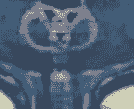 broken image