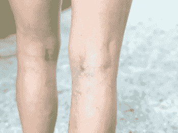 broken image