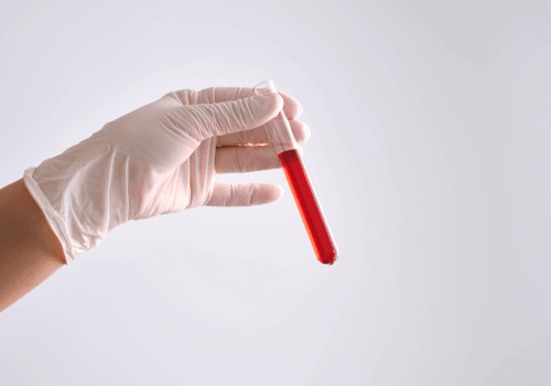 How to Interpret Your Gut Health Test Results