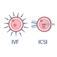 IVF/ICSI