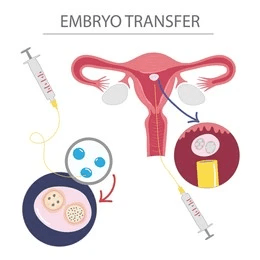 Blastocyst transfer