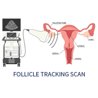 Follicle tracking scan