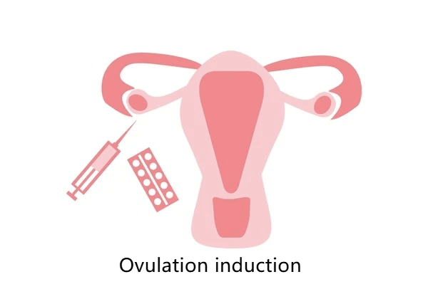 Ovulation induction