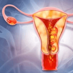 Endometrial and ovarian rejuvenation