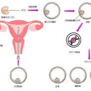 Time lapse imaging (Embryoscope)