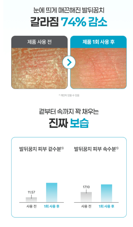 Derma:B 尿素足霜 80ml