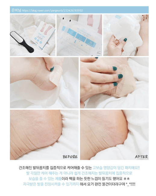 RiRe Heel Care 足部護理貼 10 片