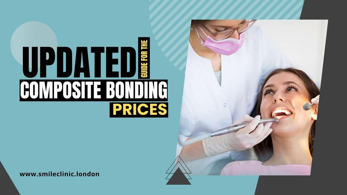 Your 2026 Updated Guide for the Composite Bonding Prices