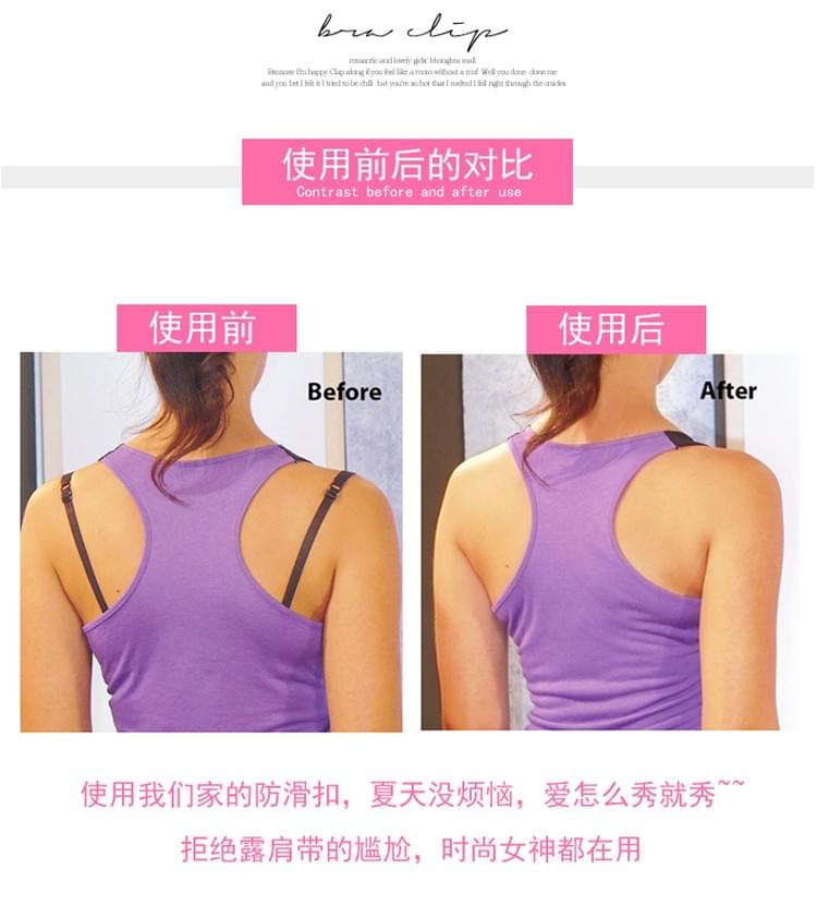 Butterfly-shaped anti-slip buckle