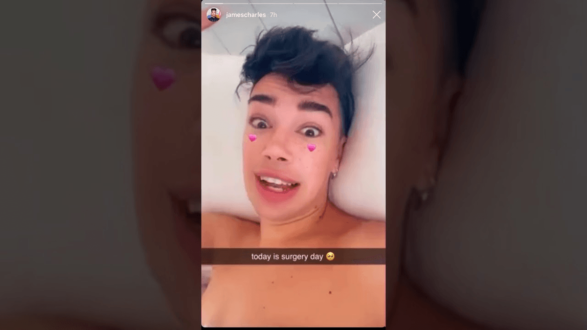 Naked james charls