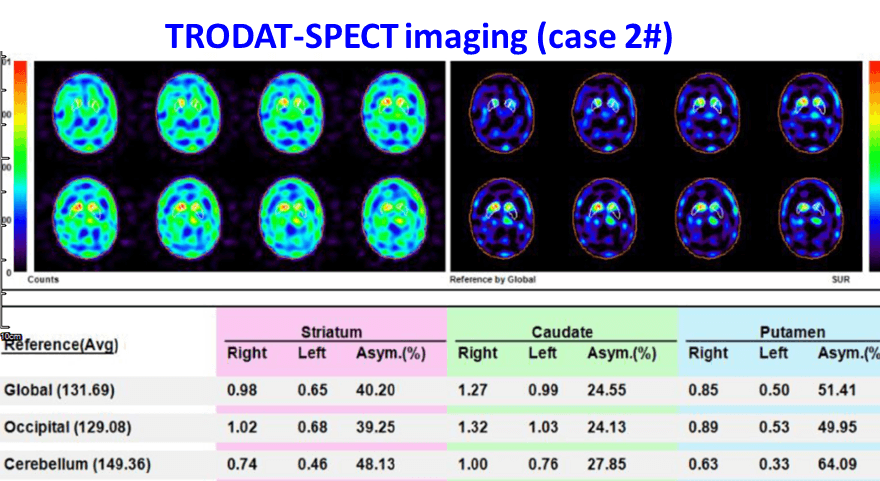Through real-time data analysis, doctors can quickly obtain patients' health status and make accurate diagnoses. real time data analysis Our solution Regarding medical software development tools, the website includes product features, literature publications, contact us items, the main customers of this software are doctors.