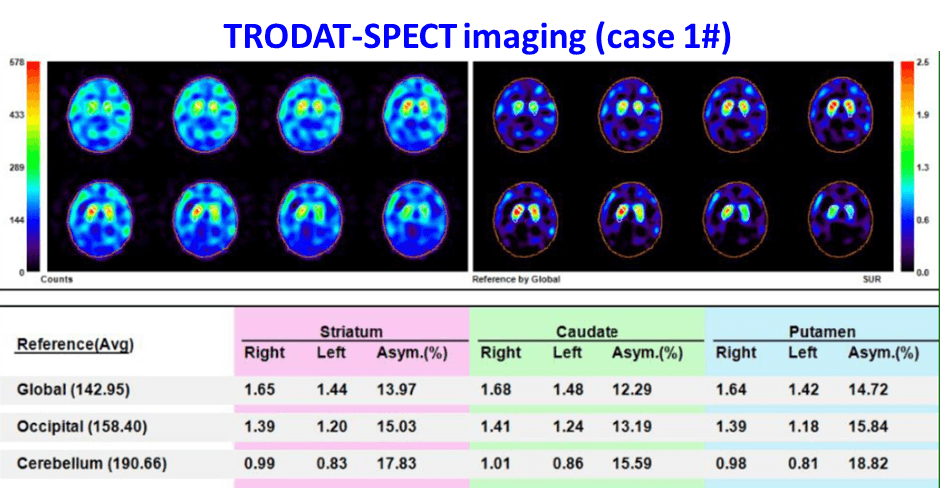 Our patient management system can simplify medical record keeping, appointment scheduling, allowing doctors to focus on providing better care. patient management system Our solution Regarding medical software development tools, the website includes product features, literature publications, contact us items, the main customers of this software are doctors.