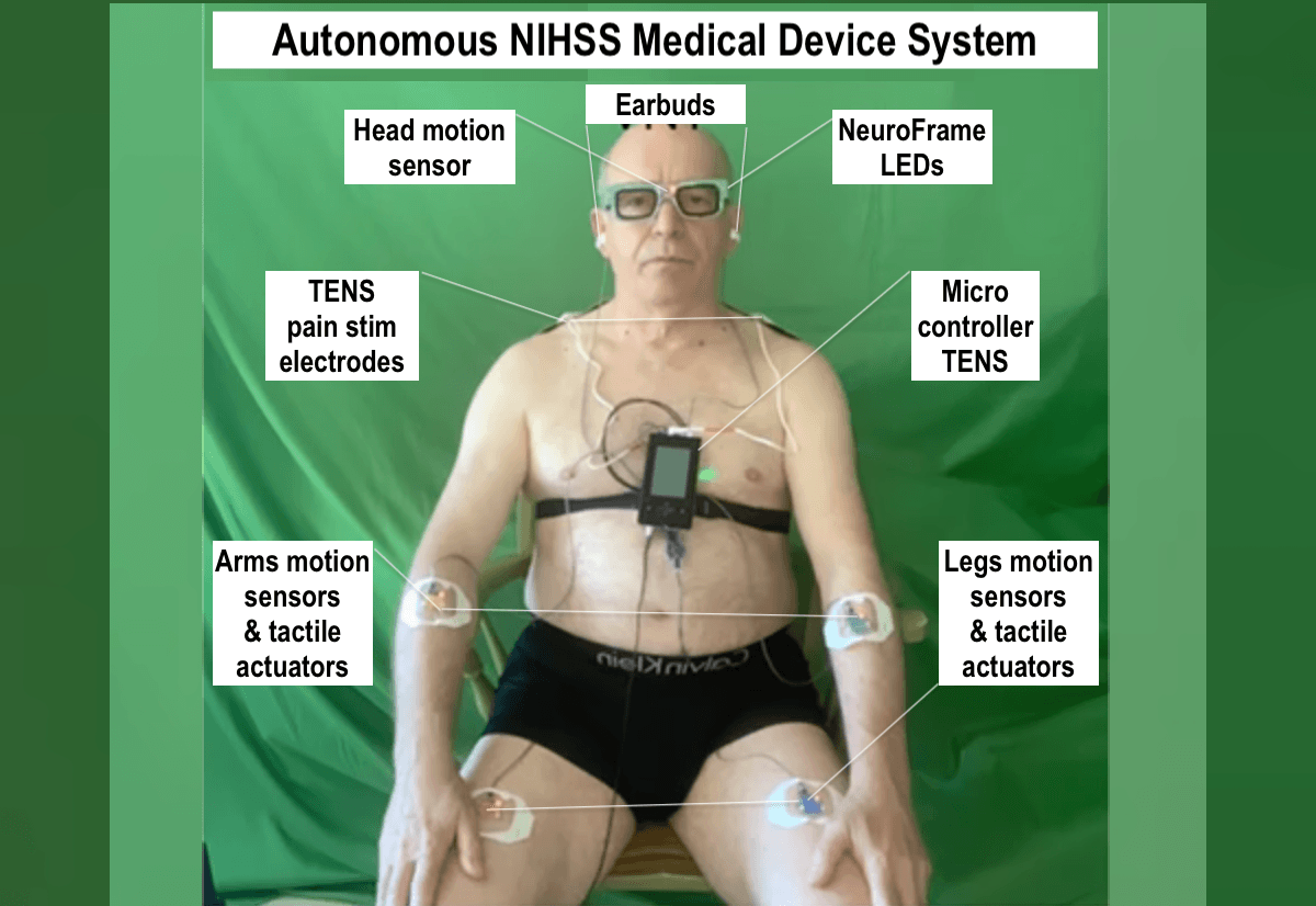 Discover OpenNIHSS.ai's Innovative Solution Empower Your Stroke Assessment OpenNIHSS.ai introduces a cutting-edge medical device that performs fully autonomous NIH Stroke Scale (NIHSS) assessments. Designed to support faster, more accurate stroke diagnosis, the device interacts directly with patients, operates 24/7, and delivers real-time clinical reports—eliminating the need for manual scoring. Whether in hospitals, ambulances, or remote clinics, OpenNIHSS.ai empowers healthcare providers with reliable, automated stroke evaluation to improve outcomes and save critical time.