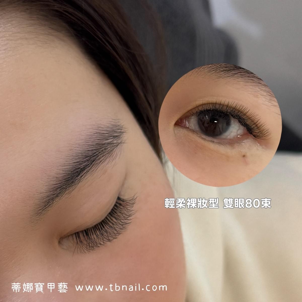 多 根 式 嫁 接
