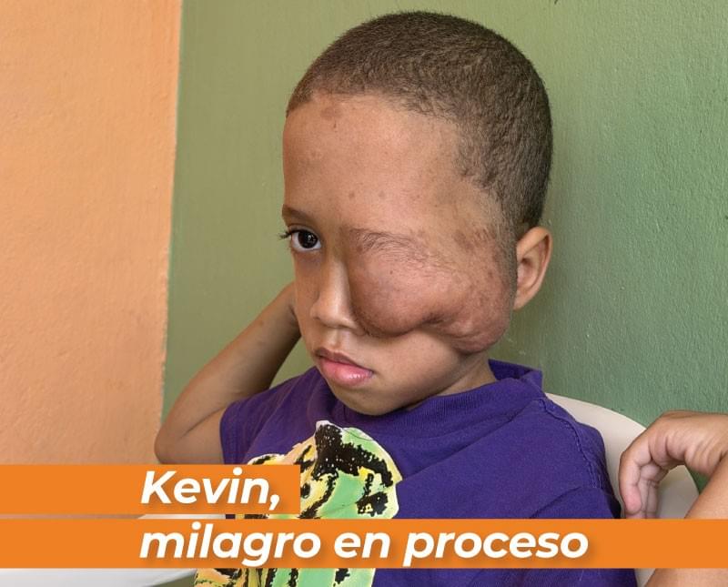 donacion