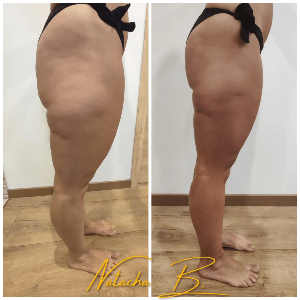 drainage lymphatique manuela shala dans l'ain