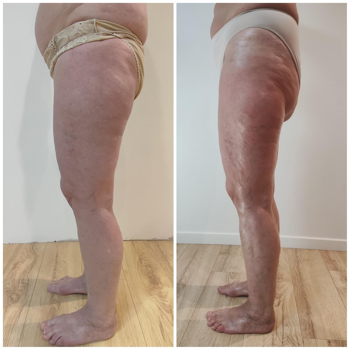 drainage lymphatique manuela shala à amberieu en bugey dans l'ain