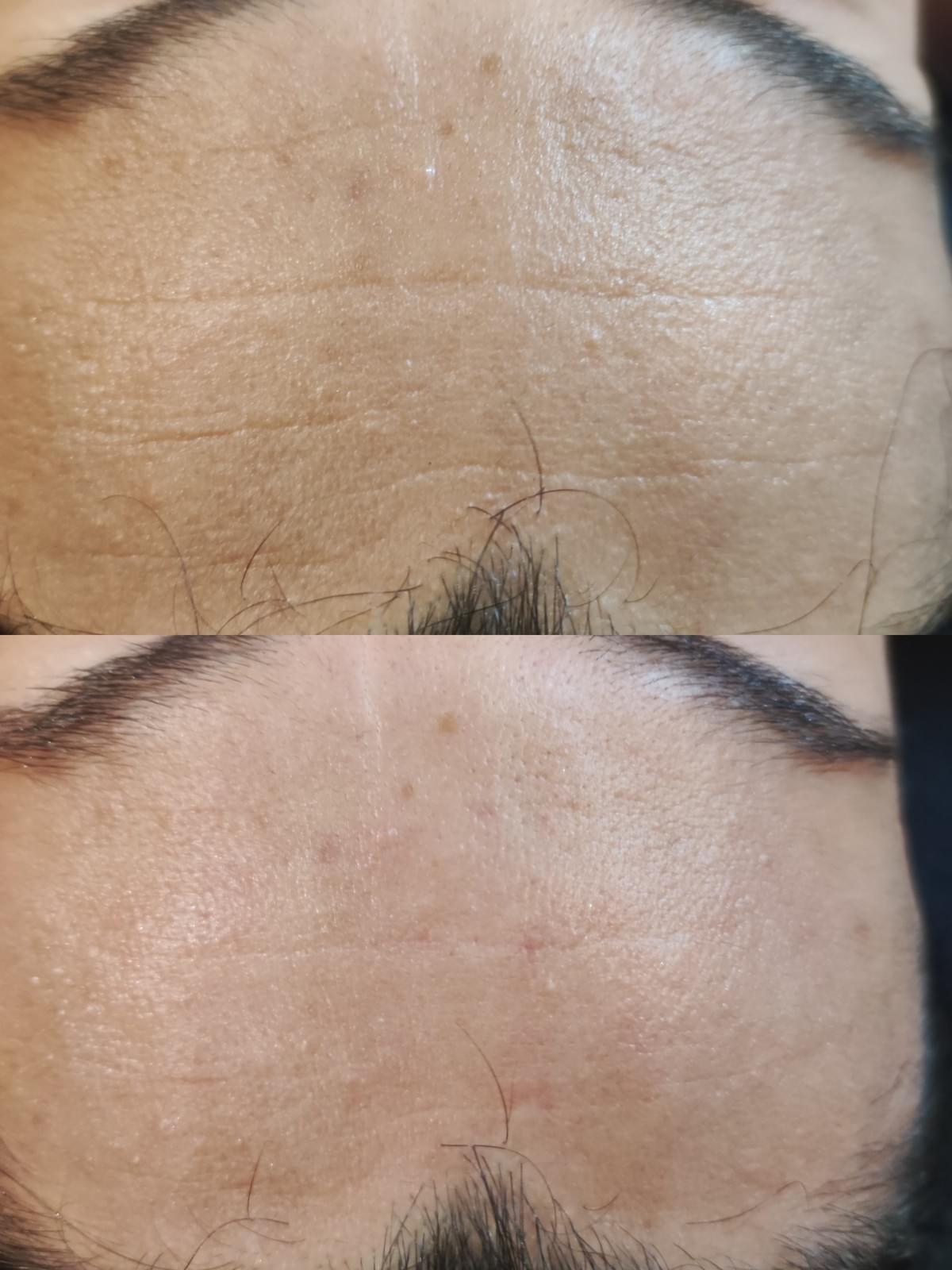 soin facialisme et kobido dans l'Ain 