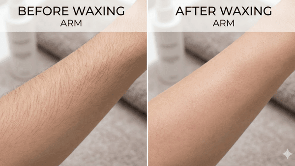 竹北蜜蠟除毛前後對照：愛美女王除毛前毛髮分布，除毛後肌膚呈現透亮絲滑感。使用高品質低敏蜜蠟，不僅去除雜毛更能溫和代謝老廢角質，達到極簡發光的細緻膚質。